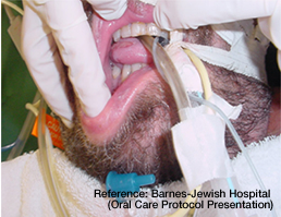 ICU Patient